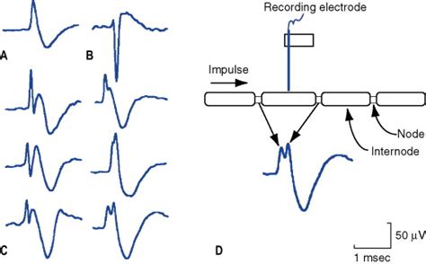 Microneurography: how it started and how it works 